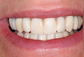 Kenny Williams, DDS | Digital Radiography, Oral Cancer Screening and Invisalign reg