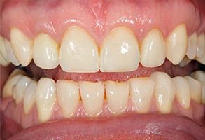 Kenny Williams, DDS | Extractions, Root Canals and Snoring Appliances