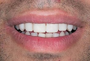 Kenny Williams, DDS | Teeth Whitening, Cosmetic Dentistry and Emergency Treatment
