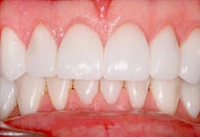 Kenny Williams, DDS | Teeth Whitening, Sedation Dentistry and Ceramic Crowns