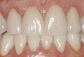 Kenny Williams, DDS | Preventative Program, Emergency Treatment and Snoring Appliances