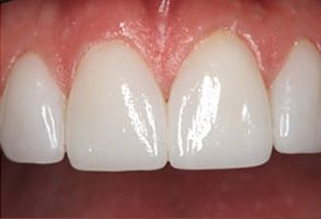 Kenny Williams, DDS | Digital Radiography, Root Canals and Teeth Whitening