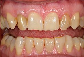 Kenny Williams, DDS | Extractions, Dental Fillings and Night Guards