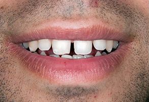Kenny Williams, DDS | Sleep Apnea, Cosmetic Dentistry and Orthodontics