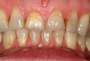 Kenny Williams, DDS | Emergency Treatment, Preventative Program and Oral Exams