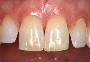 Kenny Williams, DDS | Ceramic Crowns, Emergency Treatment and Teeth Whitening