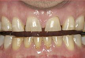 Kenny Williams, DDS | Cosmetic Dentistry, Ceramic Crowns and Night Guards