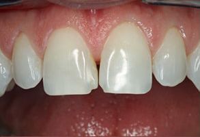 Kenny Williams, DDS | Extractions, Sedation Dentistry and Emergency Treatment